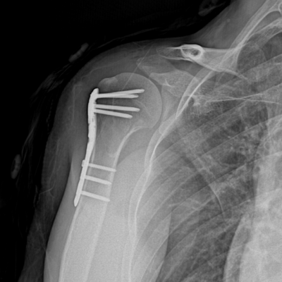 pro orthopedics and sports medicine