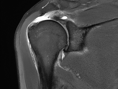 pro orthopedics and sports medicine