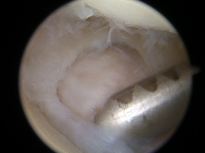 pro orthopedics and sports medicine