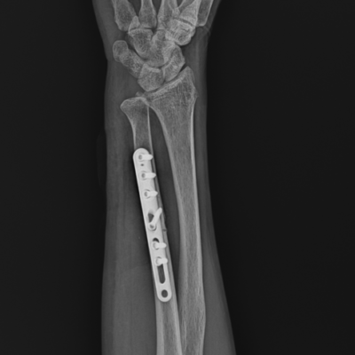 pro orthopedics and sports medicine